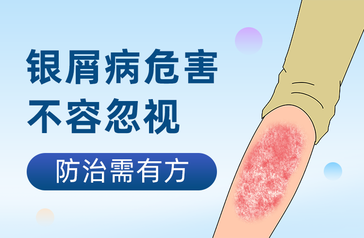 疾病优癣在线